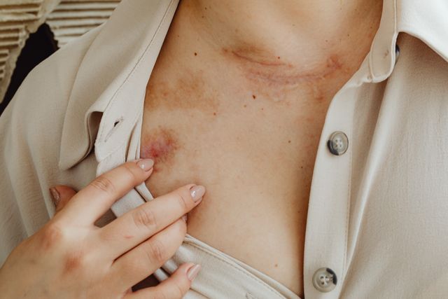 15 Round Skin Rashes: Causes, Symptoms, and When to See a Doctor